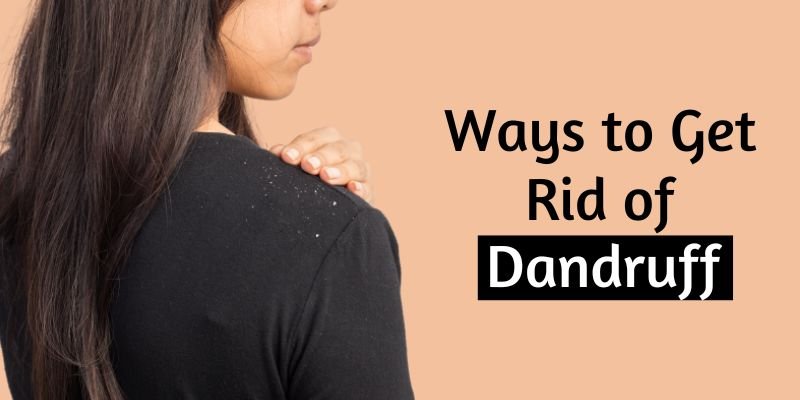 Ways to Get Rid of Dandruff