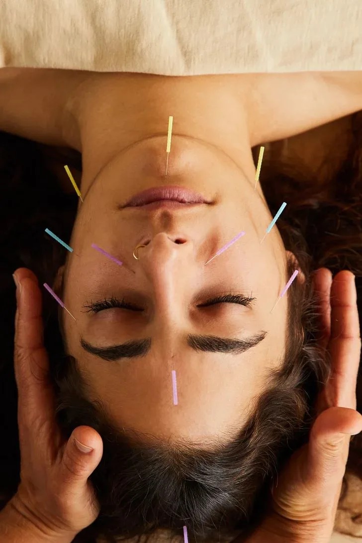 Acupuncture for Stress Relief