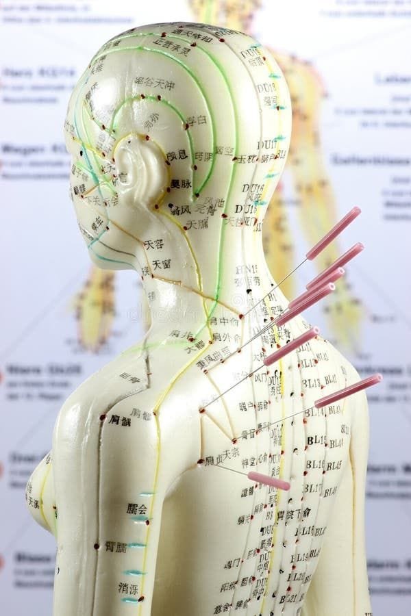 Acupuncture